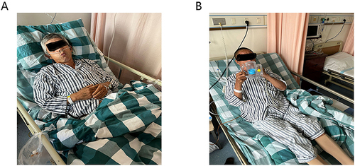 Figure 2 Two intervention exercises for patients following abdominal surgery. (A) Diaphragmatic breathing. (B) Volume incentive spirometry.
