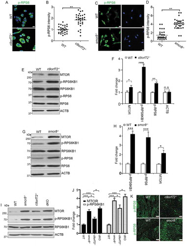 Figure 6. Upregulation of MTOR protein and MTORC1 signaling in mutant macrophages. (A and C) Confocal microscope images of macrophages stained with antibodies against phospho-RPS6/S6 (S235/S236) (green) from mutant mice. Hoechst stains the nuclei (blue). Scale bars: 10 μm. (B and D) Quantification of relative intensity of phospho-RPS6/S6 (235/236). Error bars represent SEM of 3 independent experiments; wild type (n = 30) and mutant (n = 30) cells were measured in each experiment; **p < 0.01 (Student’s t test). (E, G, and I) Western blot analyses of proteins as indicated in mutant macrophages. ACTB serves as the loading control. (F, H, and J) Quantification of protein levels normalized to ACTB. Error bars represent SEM of 3 independent experiments; *p < 0.05, **p < 0.01 and ***p < 0.001; n.s represents no significant difference (Student’s t test). (K) Representative phospho-RPS6/S6 immunohistochemistry in red pulps of spleens showing increased MTORC1 signaling in mutant spleens. Scale bars: 50 μm.