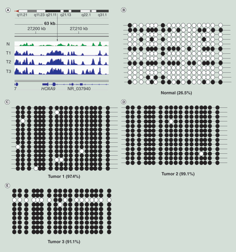 Figure 4.  Validation of MIRA-seq peaks by sodium bisulfite sequencing. (A) MIRA-seq was performed on DNA from normal melanocytes (N, green) and three melanoma samples (T1, T2, T3, blue). The vertical arrow indicates the region of the HOXA9 gene analyzed by bisulfite sequencing. (B) Bisulfite sequence data for normal melanocytes. (C–E) Bisulfite sequence data for three melanoma tumors. Open circles: unmethylated CpG sequences; black circles: methylated CpG sequences. The percentages indicate percentage of methylated CpGs.