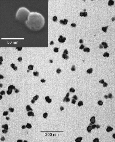 Figure 1 Transmission electron microscopy and scanning electron microscopy (top) of Fe3O4@Au-C225 magnetic nanoparticles.Abbreviation: C225, cetuximab.