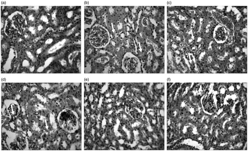 Figure 6. Representative photomicrographs from the kidney showing the protective effect of RUT against Cd + EtOH-induced renal injury in rats. (a) Control: No visible lesions seen (b) Cd: There is a diffuse tubular and glomerular degeneration (small arrows). (c) Cd + EtOH: Severe renal cortical congestion and diffuse tubular and glomerular degeneration (small arrows). (d) 25 RUT + Cd + EtOH: severe glomerular degeneration and necrosis (arrows). (e) 50 RUT + Cd + EtOH: No visible lesions seen (f) 100 RUT + Cd + EtOH: No visible lesions seen. H & E; mag ×400.