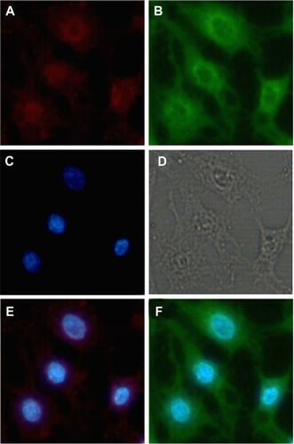 Figure 9 Fluorescent images of cells incubated with the fluorescent ternary nanoparticles for 6 hours. The cells were treated with Hoechst 33342 to detect the nucleus, SLNs were labeled with ODA-FITC (green), and DNA was labeled with ROX (red). (A) ROX-DNA, (B) ODA-FITC-loaded SLNs, (C) nucleus, (D) observed under transmitted light, (E) merged image of ROX-DNA and nucleus, and (F) merged image of ODA-FITC and nucleus.Abbreviations: ODA, octadecylamine; FITC, fluorescein isothiocyanate; SLNs, solid lipid particles; DNA, deoxyribonucleic acid.