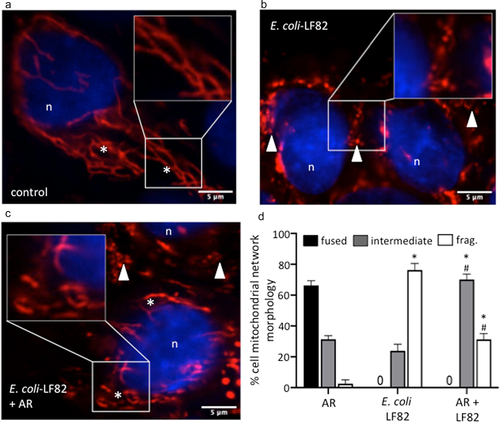 Figure 9. An FFAR3 agonist improves mitochondrial network connectivity in E. coli-LF82-infected human organoids. Monolayers of colonic organoids derived from two healthy controls were treated with E. coli-LF82 (MOI = 100, 4 h) ± a co-treatment with the FFAR3 agonist AR420626 (AR: 25 µM). Representative confocal images of MitoTrackerTM (red) and Hoescht (blue) co-stained organoids show the fused mitochondrial network of control organoid cells treated with the FFAR3 agonist alone (a), the puncta-like fragmented mitochondrial network of E. coli-LF82 infected organoid cells (b), and the intermediate fragments of the E. coli-LF82 infected organoids co-treated with the FFAR3 agonist (c) (n, nucleus; *, filamentous mitochondria; arrowhead, fragmented mitochondria). Twenty cells were assessed from four monolayers for semi-quantitative analysis (d). Data are mean ± SEM, * and #, p < .05 compared to control uninfected drug-treated cells (AR) and E. coli-LF82 only infected cells, respectively (two-way ANOVA followed by Tukey’s multiple comparison test) (frag., fragmented mitochondria).