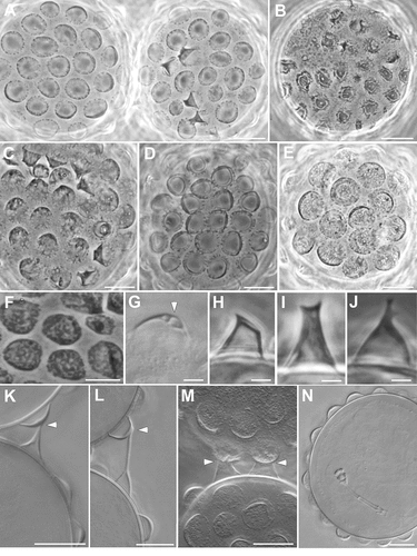 Figure 2. Ramazzottius kretschmanni sp. nov. (LM). A. Two eggs with the most common morphology. B. Egg considered aberrant. C-E. Egg. F. Egg process with “bubble-like” empty spaces within the distal wall (arrowhead). G. Egg processes considered aberrant. H-J. Abnormal egg process. K-M. Contact between two processes of different eggs (arrowhead). N. Egg with a developing embryo. A-E, G-J: PhC. F, K-N: DIC. Scale bars: A-F, K-N = 10 µm; G-J = 2 µm.