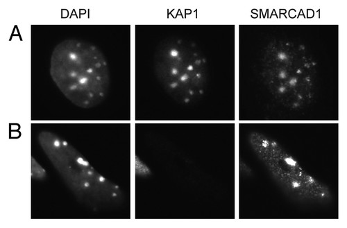 Figure 6 Localization of SMARCAD1 to pericentric heterochromatin is not dependent on KAP1 levels. (A) F9 embryonic carcinoma cells and (B) F9 cells that were engineered to express low levels of KAP1/TIF1β (TIF1β-/-/rTA-f.TIF1β) were differentiated for 7 d by exposure to 1 µM retinoic acid as described by Cammas et al. representative cells stained for KAP1 (ab22553) and SMARCAD1 Citation9 are shown, images were adjusted for brightness and contrast. DAPI bright foci mark pericentric heterochromatin.