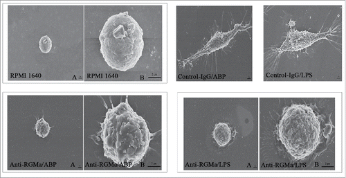 Figure 4. Morphology of DCs treated with RGMa-neutralizing antibodies under SEM. Morphology was determined after 10 μg/ml antibody treatment for 48 h (RPMI 1640 (B), Anti-RGMa/ABP (B) and Anti-RGMa/LPS groups (B) : magnification × 10,000; RPMI 1640 (A), Anti-RGMa/ABP (A), Anti-RGMa/LPS (A), Control-IgG/ABP and Control-IgG/LPS groups: magnification × 3,000.)