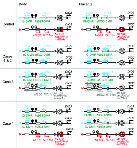 Figure 6. Schematic representation of the chromosome 14q32.2 imprinted region in a control subject, cases 1 and 2 with upd(14)pat, case 3 with a microdeletion (indicated by stippled rectangles), and case 4 with two copies of the imprinted region of paternal origin and a single copy of the imprinted region of maternal origin. This figure has been constructed using the present results and the previous data.Citation2,Citation3 P, paternally derived chromosome; M, maternally derived chromosome. Filled and open circles represent hypermethylated and hypomethylated DMRs, respectively; since the MEG3-DMR is grossly hypomethylated and regarded as non-DMR in the placenta, it is painted in gray. PEGs (DLK1 and RTL1) are shown in blue, MEGs (MEG3, RTL1as, MEG8, snoRNAs and miRNAs) in red, a probably non-imprinted gene (DIO3) in black, and non-expressed genes in white. Thick arrows for RTL1 in cases 1–3 represent increased RTL1 expression that is ascribed to loss of functional microRNA-containing RTL1as as a repressor for RTL1.