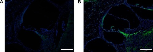 Figure 3 Coumarin 6-labeled NPs distribution in the cochlea via RWM administration at 1 hour after drug exposure.Notes: (A) Weak fluorescence was detected in the cochlear modiolus after free Coumarin 6 RWM administration. Scale bar, 500 μm. Nuclei were stained with DAPI (blue). (B) Strong green fluorescence regions were visible in the stria vascularis and organs of Corti in all the cochlear turns, as well as in the spiral ganglion cells after Coumarin 6 NPs RWM administration.Abbreviations: NP, nanoparticle; RWM, round window membrane; DAPI, 4′6-diamidino-2-phenylindole.