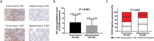 Figure 1. CXCR2 expression in NSCLC tumor tissues and adjacent tissues.IHC staining examples of CXCR2 expression tumor tissues and adjacent tissues (A). IHC semi-quantitative score of CXCR2 expression in tumor tissues and adjacent tissues (B). Percentage of CXCR2 high expression and low expression in tumor tissues and adjacent tissues (C). Comparison of IHC semi-quantitative score of CXCR2 expression was done by paired-samples t-test, and comparison of CXCR2 high expression and low expression between tumor tissues and adjacent tissues was done by McNemar test. P < 0.05 was considered significant. CXCR2, C-X-C Chemokine Receptor Type 2; NSCLC, non-small cell lung cancer.