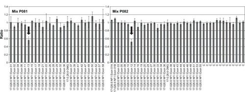 Figure 1 Bar graph showing the result of multiplex ligation-dependent probe amplification (MLPA) analysis using the SALSA MLPA P081 and P082 NF1 kits (MRC-Holland, Amsterdam, the Netherlands). Relative amounts of probe-amplified products were compared with reference samples and data analysis was performed using the Coffalyser 9.4 package (MRC-Holland). Values under a threshold of 0.7 and over a threshold of 1.3 for multiple adjacent probes indicate the presence of a deletion or duplication, respectively. The arrows highlight the exons 12 (10a) and 13 (10b) deleted in this patient.