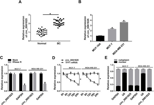 Figure 1 Circ_0061825 was overexpressed in BC tissues and cells. Circ_0061825 expression by qRT-PCR in 30 pairs of BC tissues and matched normal tissues (A), MCF-10A, MCF-7 and MDA-MB-231 cells (B). (C) Circ_0061825 and GAPDH levels by qRT-PCR in total cellular RNA incubated with RNase R. (D) The levels of circ_0061825 and TFF1 linear mRNA by qRT-PCR in MCF-7 and MDA-MB-231 cells incubated with actinomycin D. (E) Circ_0061825 expression by qRT-PCR in the cytoplasmic and nuclear fraction of MCF-7 and MDA-MB-231 cells. *P < 0.05.