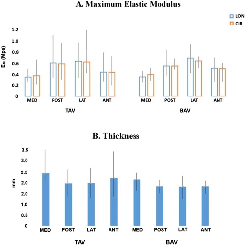 Figure 2. (A)The Maximum Elastic Modulus for the longitudinal and circumferential directions for TAV (n = 103) and BAV (n = 48) samples for each quadrants. (B) The mean thickness of TAV (n = 103) and BAV (n = 48) for each quadrants.