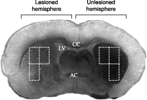 Figure 1 A representative micro-photograph showing decreased tyrosine hydroxylase staining following unilateral 6-OHDA injection in the lateral striatum of a rat that has been subjected to maternal separation. The broken lines depict the three sample areas per slide that were used to quantify TH immunocytochemical stain density using Zeiss K3100 (v.4) analyzing software. LV, left ventricle; CC, corpus callosum; and AC, anterior commissure.