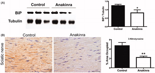 Figure 5. Anakinra reduced ER and nitrative stress. (A) Western blot quantification of BiP in DRG from mice treated with Anakinra (n = 7) and non-treated age-matched controls (n = 7). Histogram denotes normalized BiP/Tubulin density quantification ± SEM (*p < 0.05). (B) Representative SQ-IHC pictures of 3-nitrotyrosine in sciatic nerve of mice treated with Anakinra (right panel, n = 10) and age-matched controls (left panel, n = 10). Scale bar 50 µm. Chart represents the quantification of immunohistochemical images, and data represent mean ± SEM (**p < 0.01).