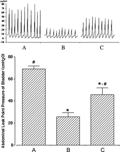 Figure 1.  Effect of human adipose-derived stem cells (ADSCs) on the abdominal leak point pressure after induction of stress urinary incontinence (SUI). Upper panel: photomicrographs of the abdominal leak point pressure. Lower panel: the mean±SEM of the abdominal leak point pressure in sham-operation (A), SUI-induction (B) and SUI-induction followed by human ADSC injection (C) groups. * represents P<0.05 compared with the sham-operation group and # represents P<0.05 compared with the SUI-induction group.