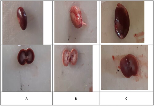 Figure 1. Macroscopically appearance of the kidney. Normal diet (A); vancomycin exposed group without treatment (B); vancomycin exposed group treated with vitamin D3 (C).