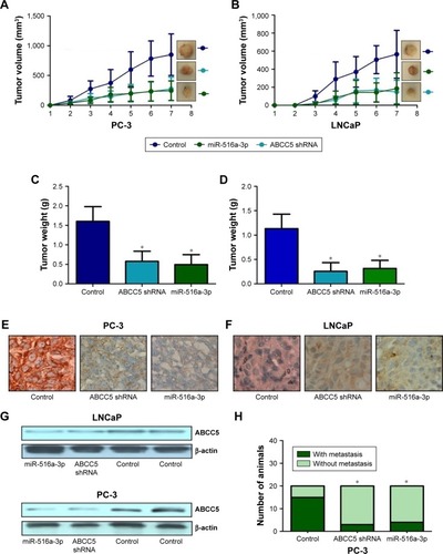 Figure 5 ABCC5 plays an essential role in PCa growth and metastasis in vivo. Ectopic expression of miR-516a-3p can mimic the results induced by knockdown of ABCC5 in PCa cells. (A, B) Knockdown of ABCC5 in PC-3 and LNCaP cells significantly inhibits tumor growth in a mouse xenograft model. (C, D) Tumor weights of the corresponding mouse xenograft models. (E, F) ABCC5 expression analysis was studied at the protein level by immunochemistry. (G) ABCC5 expression analysis was investigated at the protein level by Western blot. (H) ABCC5 played an important role in PCa metastasis in vivo via targeting ABCC5. Ectopic expression of miR-516a-3p can mimic the effects induced by ABCC5 knockdown. *P<0.05.