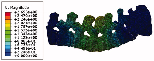 Figure 6. Displacement nephogram of the lumbar spine subjected to the concentrated force in the finite element simulation.
