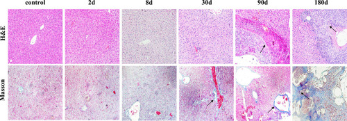 Figure 1 Pathological changes in the liver of mice infected with Echinococcus multilocularis (x200).