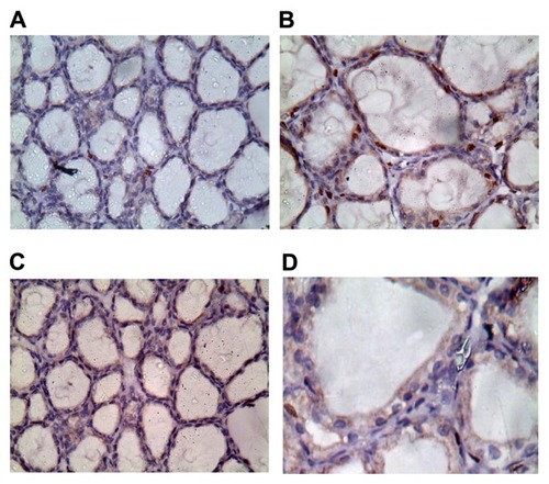 Figure 4 (A–D) Ki67 staining in thyroid tissues at high magnification power (40×).Notes: (A) Thyroids of group 1 exhibited weak proliferation, as shown by Ki67-positive nuclei. (B) thyroids of group 2 showed strong positive nuclear immunostaining. Thyroids of group 3 (C) and group 4 (D) showed weak positive nuclear immunostaining.