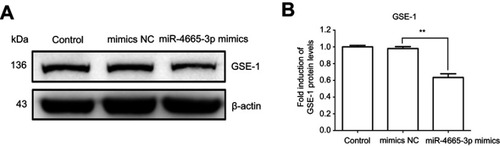 Figure 6 GSE1 is a direct target of miR-4665-3p in gastric cancer cells.