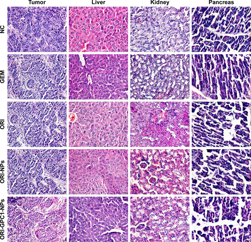 Figure S3 H&E staining of tumor and major organs gathered from control, GEM, ORI, ORI-NP, and ORI-GPC1-NP groups after treatments for 14 days.Abbreviations: GEM, gemcitabine; NC, negative control; ORI, oridonin; ORI-NPs, Gd-ORI@HAuNCs-Cy7 nanoparticles; ORI-GPC1-NPs, GPC1-Gd-ORI@HAuNCs-Cy7 nanoparticles.