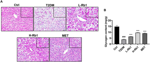 Figure 1 Rb1 treatment enhances hepatic glycogen levels in type 2 diabetes mellitus (T2DM) mice. (A) Liver samples were obtained from control mice (Ctrl), T2DM mice, mice treated with 20 mg/kg of Rb1 (L-Rb1), mice treated with 50 mg/kg of Rb1 (H-Rb1), and mice treated with 250 mg/kg of metformin (MET) and conducted periodic acid-Schiff staining. Scale bar = 50 μm. The upper right corner box refers to the coloring area of PAS under the same area. (B) Liver glycogen levels; n = 6. ###P < 0.001 vs the Ctrl group; ***P < 0.001 vs the T2DM group.