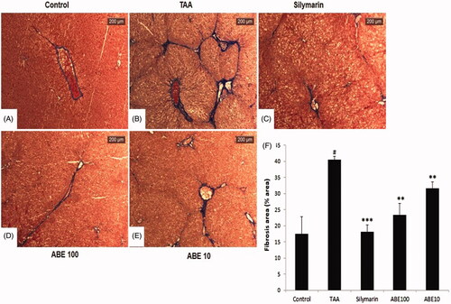 Figure 6. Masson’s trichrome stain of liver tissues. This stain was performed like H&E stain. Control: naive rats (A), TAA: TAA-induced liver fibrosis rats (B), Silymarin: Positive control rats (C), ABE 100: ABE 100 mg/kg treated rats (D), ABE 10: ABE 10 mg/kg treated rats (E), Fibrosis are plot (F). Scale bar =200 μM. Quantification was done using ImageJ. Values are represented as mean ± SEM (n = 6) using one-way analysis of variance (ANOVA) followed by Student’s t-test. #p < 0.05 as compared with control group, **p < 0.01, ***p < 0.001 as compared with TAA group. TAA: Thioacetamide-induced liver fibrosis rats, Silymarin: Positive control rats, ABE 100: ABE 100 mg/kg treated rats, ABE 10: ABE 10 mg/kg treated rats.