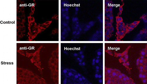 Figure 4.  Stress-induced nuclear translocation of GR in Leydig cells. Immunofluorescence laser confocal microscopy was used to determine the subcellular localisation of GR in Leydig cells in both control and stressed rats. The blue Hoechst stain defines the nuclear boundary. GR (red) was localised within the cytoplasm in Leydig cells of control rats, but were translocated to the nucleus in Leydig cells of rats exposed to chronic unpredictable stress (CUS) (stress). These data showed that CUS induced GR nuclear translocation in Leydig cells.