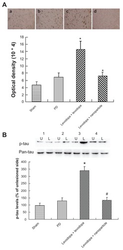 Figure 9 Effect of administration of LDME/benserazide-loaded nanoparticles on p-tau levels. (A) Immunohischemistry results showed that elevated levels of p-tau were found in LDME-plus benserazide-treated dyskinetic rats. Administration of LDME/benserazide-loaded nanoparticles reduced the increase of p-tau in dyskinetic rats. (B) Western blot results showed that administration of LDME plus benserazide induced increased levels of p-tau. Administration of LDME/benserazide-loaded nanoparticles prevented the increase of p-tau.Notes: (A) *P < 0.01 versus PD group; #P < 0.01 versus levodopa + levodopa. (B) *P < 0.05 versus PD group; #P < 0.05 versus levodopa + levodopa. n = 6 per group. Statistical analysis was performed using one-way analysis of variance, followed by Dunnett’s t-test.Abbreviations: L, lesioned side; LDME, levodopa methyl ester; PD, Parkinson’s disease; p-tau, phosphorylated tau; U, unlesioned side.