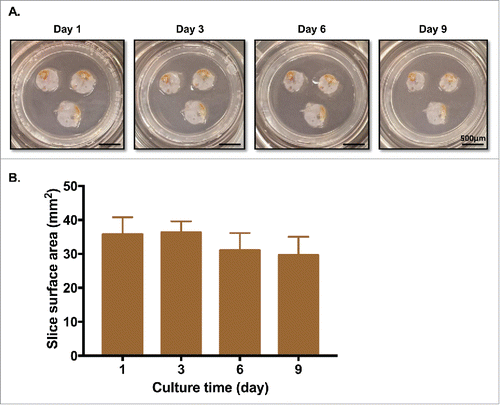 Figure 2. PDA tumor slices maintain morphology and surface area for over a week in culture. (A) PDA slices were cultured for up to 9 d, with fresh media changes performed every 2–3 d. Bar = 500 μm. (N = 3) (B) Surface area (mm2) of each slice was measured by analyzing photographs with Fiji Image J. There were no significant differences in surface area among days 1, 3, 6, and 9. (N = 3) Error bars represent STDEV.