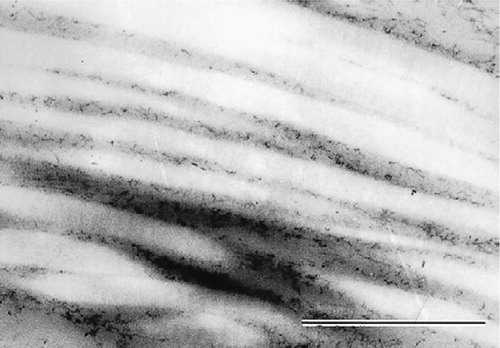 Figure 6. The collagen fiber density was markedly reduced with aging and the fiber diameter tended to be increased slightly, but there was no change in the periodicity of banding (×36,000).