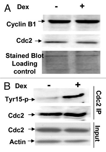 Figure 7 Induction of Wip1 increases the level of inhibitory tyrosine phosphorylation on Cdc2 protein. (A) The levels of nuclear cyclin B and cdc2 proteins are the same between the Wip1 induced and uninduced cells at time of 12 h. The western blot prepared from the nuclear fraction of Wip1 induced (+) and uninduced (−) U2–15 cells at time of 12 h, was blotted by cyclinB and cdc2 antibodies, respectively. There is no detectable difference in both protein levels of Cdc2 and cyclin B between lane (−) and lane (+). Cytoplasmic levels of both proteins were also the same between Wip1 induced and uninduced cells (data not shown) (the stained blot for the control of protein loading). (B) The level of inhibitory tyrosine phosphorylation on Cdc2 is increased when wip1 is induced. The immunoprecipitate from the total soluble protein of uninduced (lane−) and induced (lane+) U2–15 cells at time of 12 h using anti Cdc2 antibody was detected by anti-phosphotyrosine-15 monoclonal antibody. There is an increased level of inhibitory phosphotyrosine on Cdc2 protein in Lane (+). The same blot shown in the top part of (B) was stripped and detected using anti-Cdc2 antibody. There is no detectable difference in Cdc2 protein level between lane (−) and lane (+) (the middle part of B). The IP input control is provided (the bottom part of B).