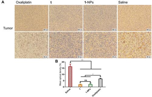Figure 10 Photography of immunohistochemical staining of MMP-9 in tumor tissues from mice treated by 1, 1-NPs oxaliplatin and saline. (A) Representative micrographs. (B) Quantified data of immunohistochemistry analysis.