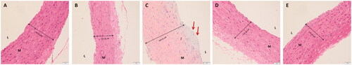 Figure 4. Histopathological changes in the rats’ thoracic aortas after 4 weeks of CNME treatment (magnification, ×400). (A) The non-diabetic control group (C) showed an intact vascular layer and no impairment of the vessel wall. (B) The non-diabetic group treated with 500 mg/kg CNME (C + CNME) showed an intact vascular layer and no impairment to vessel integrity. (C) In the untreated diabetic group (DM), the aortas appeared to be thick and exhibited disorientation of the smooth muscle cells with foam cell formation. (D) In the diabetic group treated with 300 mg/kg metformin (DM + Met), the aortas showed a thinner vascular wall compared to the untreated diabetic group’s aortas with no foam cell formation. (E) In the diabetic group treated with 500 mg/kg CNME (DM + CNME), the aortas had a thinner vascular wall compared to the untreated diabetic aortas, no impairment of the vascular wall, and no foam cell formation. The double arrow shows the IMT measurement, the red arrows indicate the foam cells, L represents the vascular lumen, and M indicates Media.