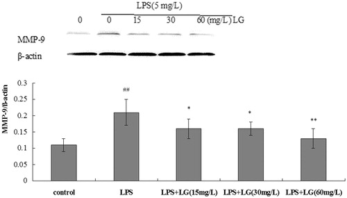 Figure 6. Effect of Ligustrazine on MMP-9 expression induced by LPS in RPMCs. Cells were treated for 24 h with 5 mg/L of LPS in the absence or the presence of Ligustrazine (15, 30, and 60 mg/L). The histograms represent a densitometric analysis of MMP-9/β-actin ratio. Data represent mean ± SD of three independent experiments. *p < 0.05, **p < 0.01 versus LPS; #p < 0.05, ##p < 0.01 versus Control. LG: Ligustrazine.