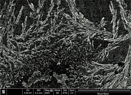 Figure 6 TEM micrograph of lyophilized hydrogel microparticles.