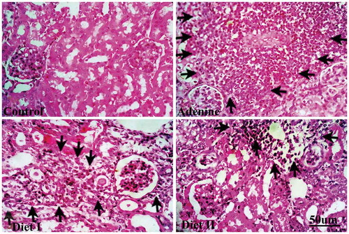Figure 3. Representative photographs showing recruitment of inflammatory cells (arrows) and tubular injury in kidney sections (hematoxylin-eosin stain) isolated from (a) control group, (b) adenine group, (c) diet I group (Persea Americana fruit 50% w/w in diet), and (d) diet II group (Persea Americana fruit 100% w/w diet)