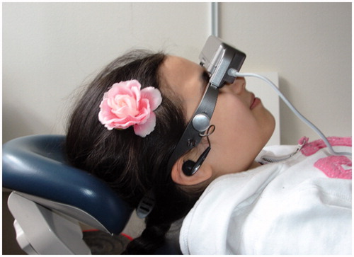 Figure 1. Illustration of the AV distraction eyeglass goggle Merlin i-theatre™ in a clinical setting.