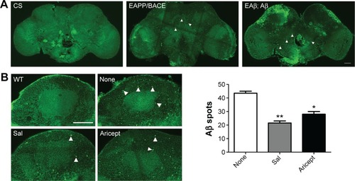 Figure 3 Effect of Sal on Aβ accumulation in vivo and Aβ induced neurotoxicity in vitro.