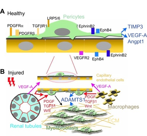 Figure 3 Microvascular pericytes in healthy and injured kidneys.