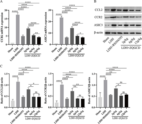 Figure 9 CCL2/CCR2 pathway and ASIC3 were highly in DRG of LDH rats expressed but inhibited by CCR2 inhibitor or ZQGCD. (A) Bar graphs showing the expression levels of CCL2 and CCR2 mRNA in DRG. (B and C) Immunoblot and bar graphs showing the expression levels of CCL2 and CCR2 in DRG. *P<0.05, **P<0.01, ****P<0.0001, ns: P>0.05.