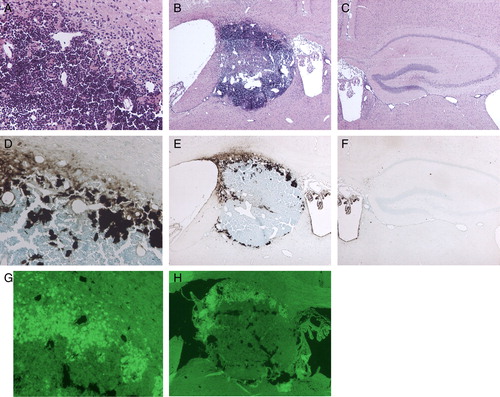 Figure 2. Photomicrographs of HE (A, B, C), Peal's (D, E, F), and TUNEL staining (G, H) after continuous injection of Fe-NTA for 4 weeks. The hippocampus was totally destroyed and replaced by inflammatory cells (A, B). High-level iron accumulated at a marginal area of the hippocampal space, and lower level iron was observed on the choroid plexus and ependymal cells of the third ventricle (D, E). Localization of TUNEL-positive cells corresponded to that of a higher level of iron in the hippocampal space (G, H). (Original magnification ×40 for B, C, E, F, H, and ×100 for A, D, G.)