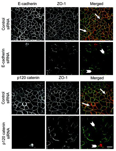 Figure 10. siRNA-mediated depletion of E-cadherin or p120 catenin prevents TJ assembly in pancreatic epithelium. Immunolabeling and confocal microscopy show formation of normal ZO-1-based TJs in control siRNA-treated HPAF-II cell monolayers on day 4 post-transfection (arrows). In contrast, E-cadherin or p120 catenin-depleted pancreatic epithelial cells demonstrate poorly-developed and fragmented TJ strands (arrowheads). Bar, 20 µm.