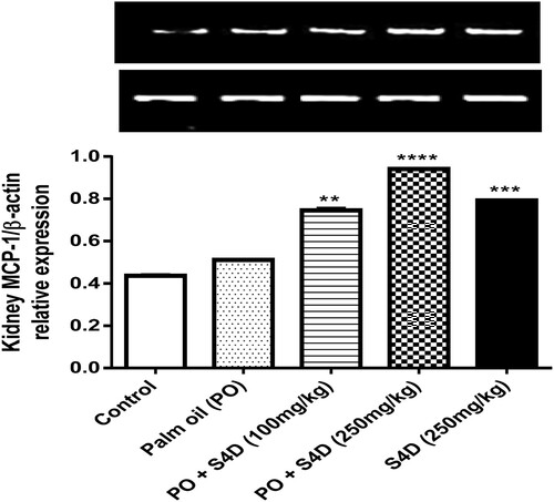 Figure 4 Effects of exposure to Sudan IV dye (S4D)-adulterated palm oil (PO) on the expression of monocyte chemoattractant protein-1 (MCP-1), relative to β-actin, in the renal tissues of control and experimental rats. Bars (mean ± S.E.M. of six rats n = 6) bearing * are significantly different from the control group at p < 0.05 (Bonferroni test).