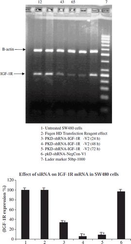 Figure 1. Down-regulation of IGF-1R mRNA in colon cancer cells following transient transfection with IGF-1R specific siRNA. Total RNA was extracted at the indicated times after transfection and IGF-1R mRNA was quantitated by semi-quantitative RT-PCR. Shown are the relative mRNA levels of IGF-1R in reference to β-actin expression. Data are expressed as the mean ± standard deviation.