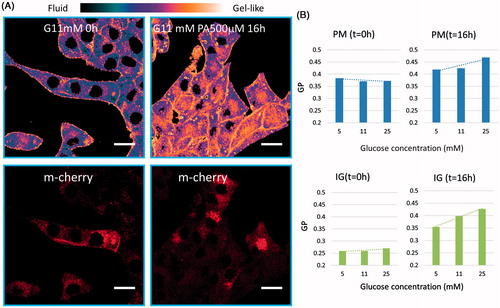 Figure 3. Effects of nutrient overload on beta cells. (A) High-resolution fluorescence images of Laurdan emission for fluidity investigation along with m-cherry emission images. Membrane fluidity is represented in terms of ratio of emission intensities by using the Generalized Polarization (GP) value. The GP ranges from −1 (very fluid-purple (black in print version)) to +1 (very gel-like-orange (white in print version)). M-cherry labels insulin granules, which have spherical shapes of about 0.5–1 μm diameter. (B) GP values of plasma membrane (PM) in cells incubated with increasing glucose concentration for 32 h. Scale bar is 10 μm.
