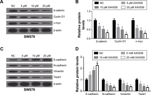 Figure 4 Inactivation of the Wnt/β-catenin pathway suppressed cell proliferation and EMT in thyroid cancer cells.