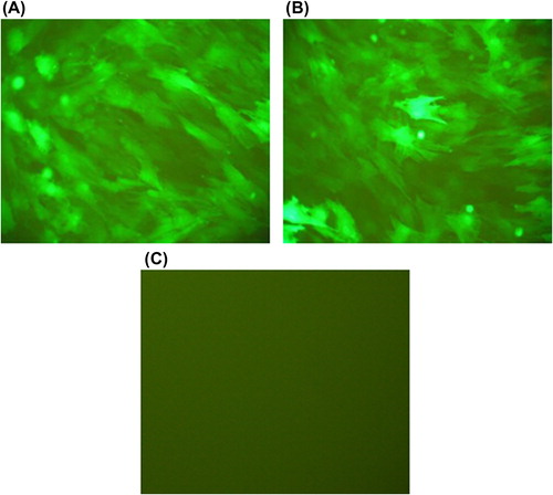 Figure 9. Green fluorescence distribution in the ASCs (× 200). (A) Green fluorescence expression in the ASCs of the experimental group. (B) Green fluorescence expression in the ASCs of the control group. (C) The untransfected ASCs under the fluorescence microscope.