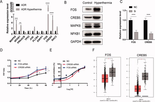 Figure 4. The validation experiment of hub genes. (A) The differences in gene expression of 10 hub genes were validated with RT-qPCR. (B) Western blot analysis of FOS, CREB5, MAPK8 and NFKB1 protein level. (C) The efficiency of siRNA to knockdown the expression of FOS and CREB5. (D) Cell proliferation in the si-FOS and si-CREB5 group was faster compared with that in the control group, using the CCK-8 assay. (E). Half-inhibition rate of adriamycin in MCF-7/ADR cells treated with si-FOS and si-CREB5. (F) Different expression of FOS and CERB5 between invasive breast cancer and normal breast tissue by TCGA database. Error bars represented the mean ± SD of at least three independent experiments, *p < .05, **p < .01, ***p < .001.